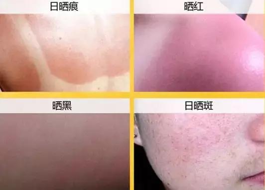 泰国防晒界“黑马”出击，每天一喷，28天白成一道光，越晒越美丽