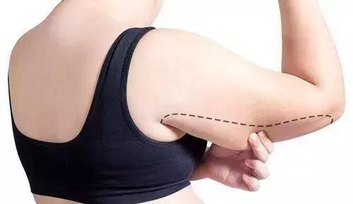 女生手臂太粗怎么练细,4个动作告别蝴蝶袖练出紧实手臂