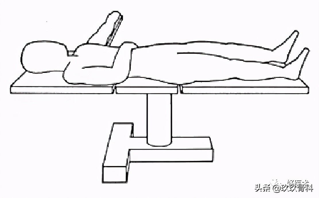 髓内钉技巧,髓内钉教学视频讲解
