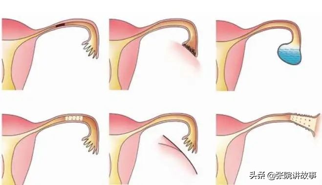 张院讲短视频,祖传中医把脉说我输卵管堵塞