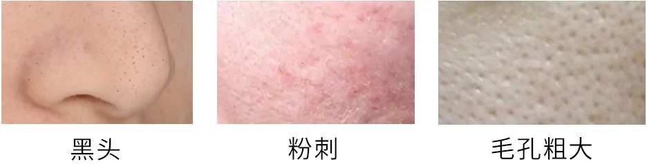 科颜氏白泥正品代购,科颜氏白泥135元