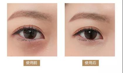 眼袋眼纹黑眼圈改善方法,去黑眼圈眼袋眼纹最有效的小妙招