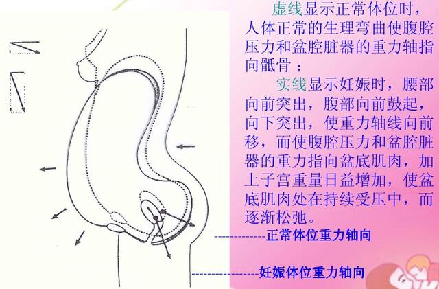 盆底肌康复训练凯格尔运动,盆底肌康复仪10大品牌