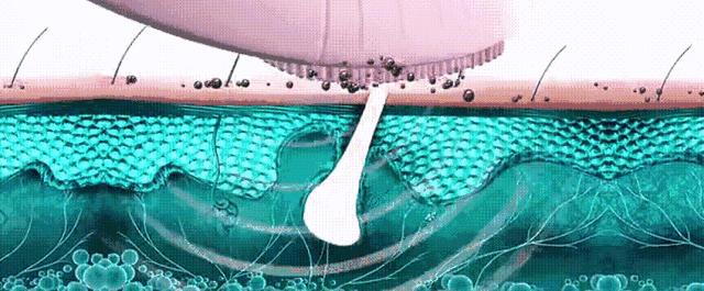 自己搓澡搓不到后背怎么办,洗澡怎样才能搓干净后背