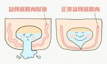 「义诊预告」市二医院将开展尿*禁失**周义诊活动