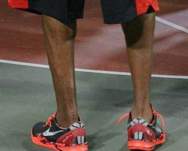 为什么nba球员小腿细还这么能跳,为什么nba大部分人小腿纤细