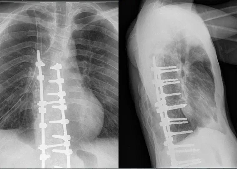 sps鍒涘浜虹悊鏌ュ痉,鐞嗘煡寰蜂翰鎺坰ps瀵煎笀