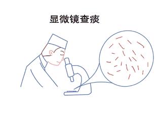 死灰复燃的病例,潜在结核病