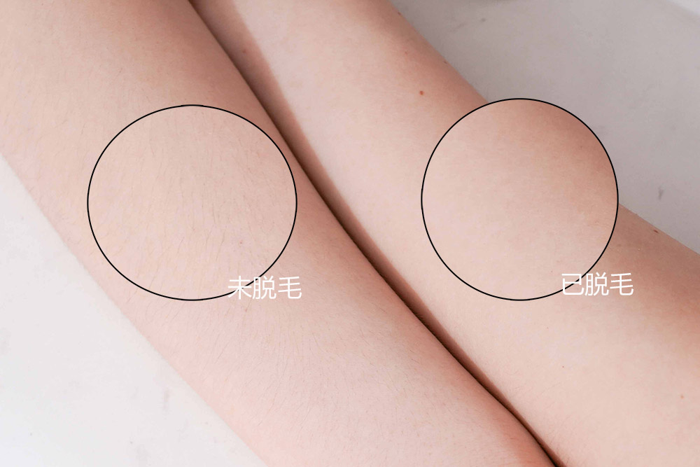 猕猴桃脱毛仪哪个好用,ulike猕猴桃脱毛仪