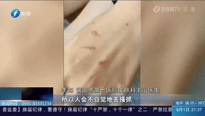 户外远离虫子的方法,哪些虫子在户外小朋友是不能碰的