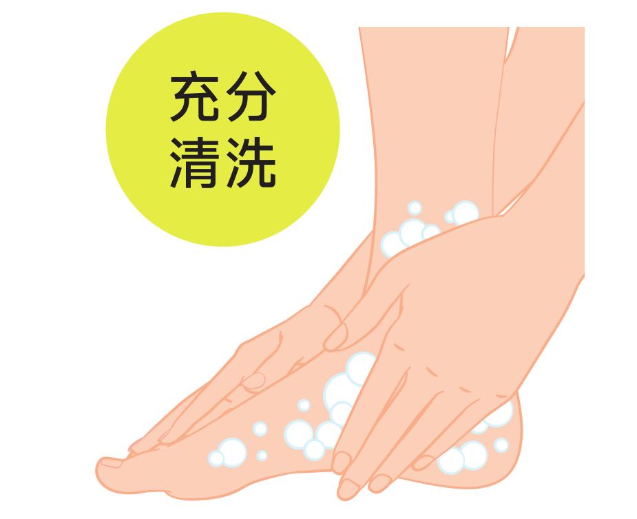 硬邦邦的老茧，会痛的鸡眼，日本皮肤科专家教你矫正足部恶习