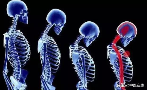 北京中医医院马彦旭主任:你的颈椎变直了么?别怕,中医有办法!