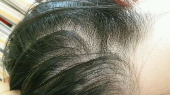 用了护发素头发好塌,用了护发素掉头发