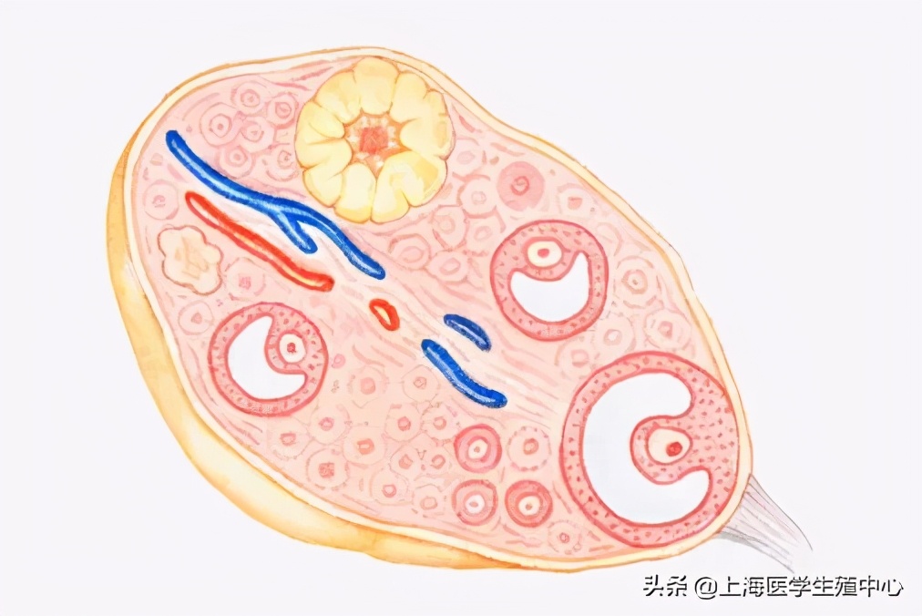 试管婴儿取完卵防止腹水,试管婴儿取完卵怎么调养身体
