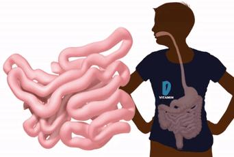 一紧张就想拉屎怎么办,一紧张就想拉屎怎么克服