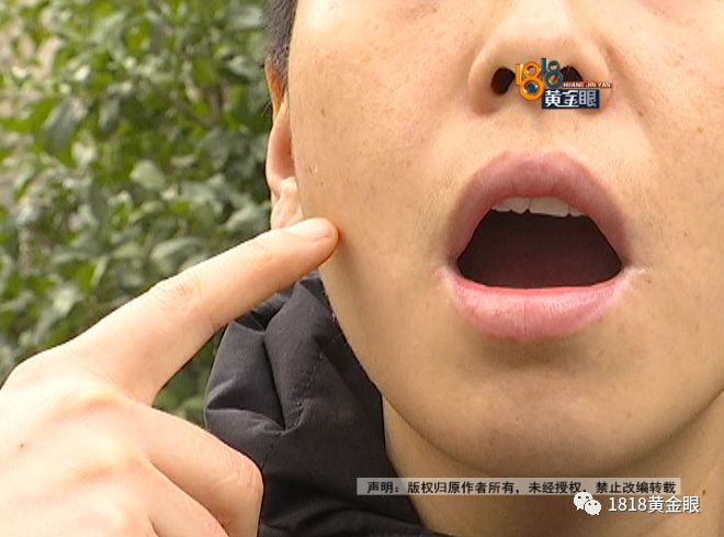 两次拔牙中间需要间隔多久,两次拔牙必须是一个医生吗