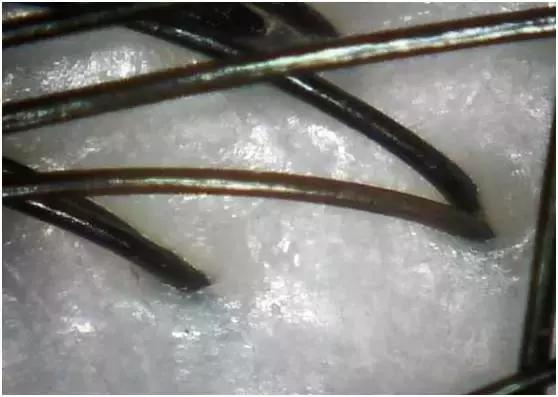 做头皮护理的十大好处,头皮理疗和护理