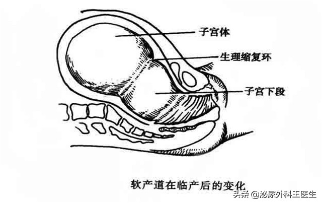 女人切除子宫后身体会有4种变化,女人切除子宫对生活有影响吗