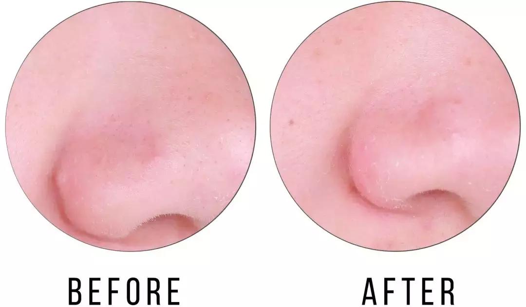 honeyroa面膜,好用的去黑头清洁面膜排行榜