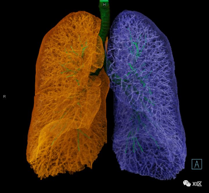 如此详细的肺部影像解剖，有点儿酷！