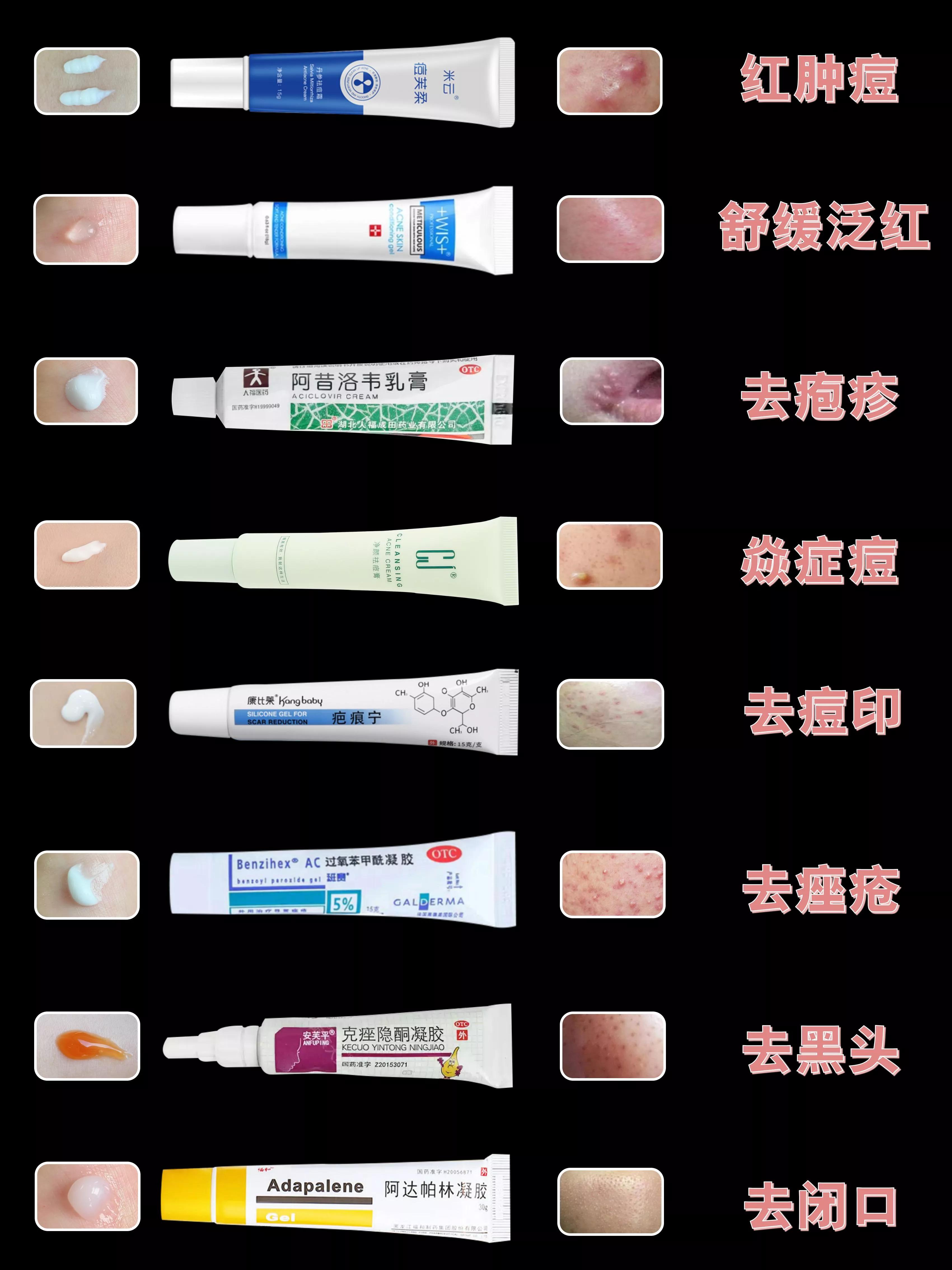 祛痘痘好物推荐精华,痘肌救星祛痘爆款