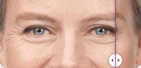 测一测看眼型决定你是什么命,测一测我有多少条鱼尾纹