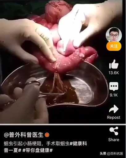 成人怎么驱逐蛔虫,驱逐蛔虫