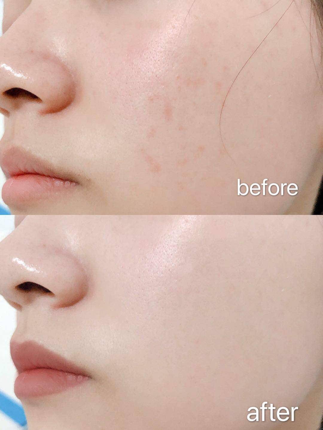 怎么养肤让皮肤细腻又白,怎么使皮肤又白又滑又紧致