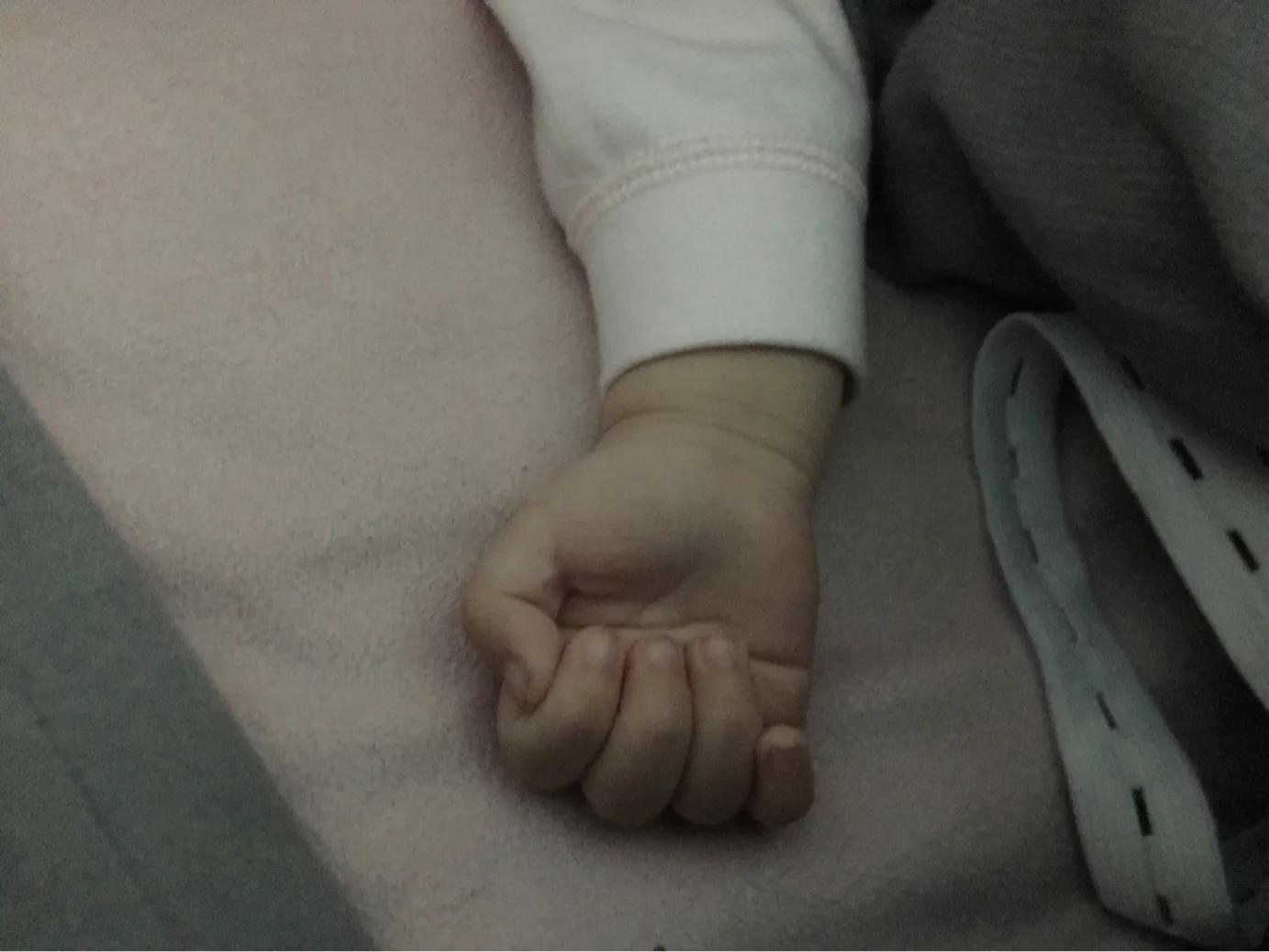 宝宝的手大拇指内弯,宝宝的拇指都是向着掌心的吗