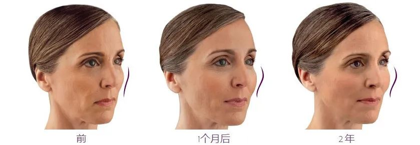 2023全球医疗器械排行榜,2018最具临床价值创新的医疗器械