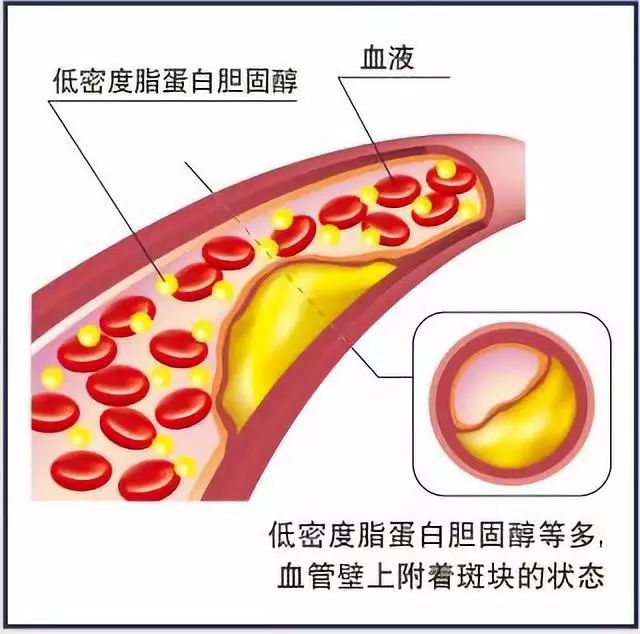 健康解密新陈代谢,日本健康促进法