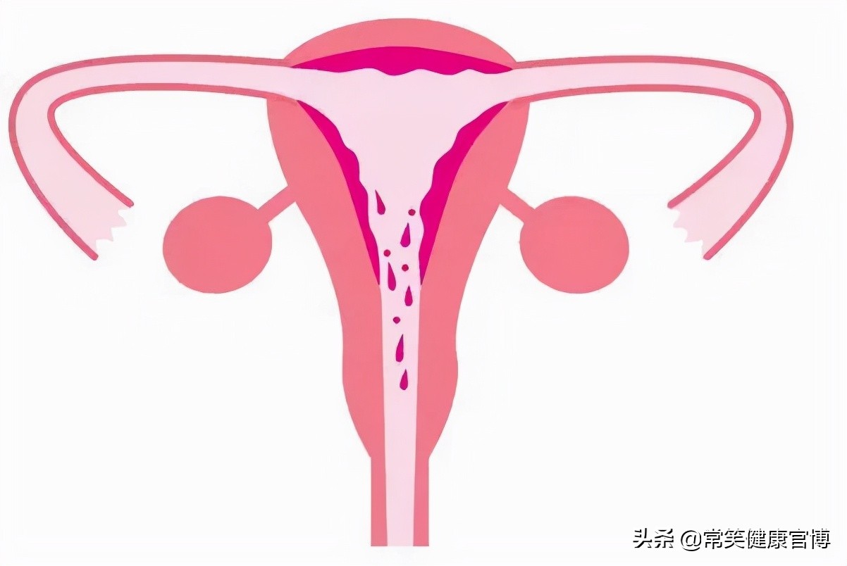 第一次来月经之后会每个月都来么,月经不是每个月都来怎么办