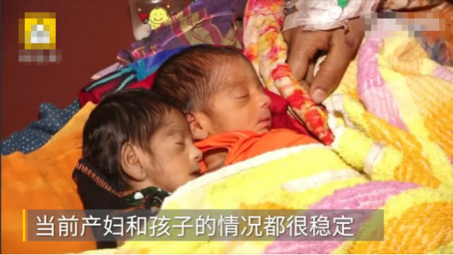 女子怀双胞胎肚子痛,女子生完三胞胎又怀上双胞胎