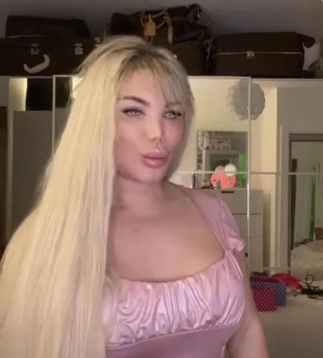 巴西男整容42次图片,巴西男模花数百万整容