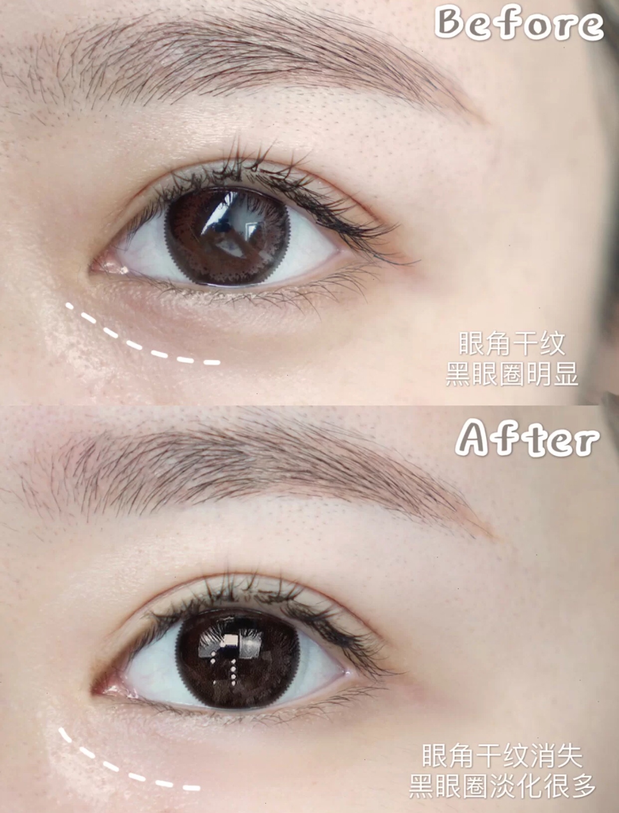 还在熬夜告别黑眼圈平价眼霜推荐,去黑眼圈的平价眼霜推荐