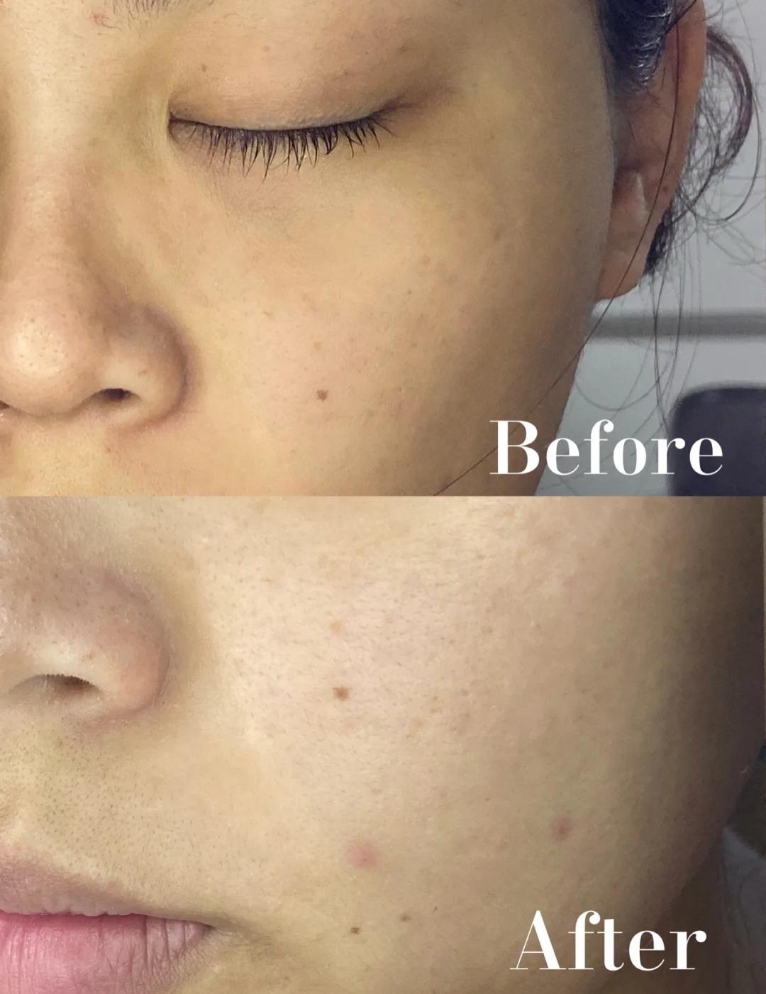 国货护肤品水乳好用推荐,国货水乳适合秋冬