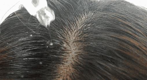 专家推荐治疗脱发白发食疗药酒,中医调理白发脱发养发