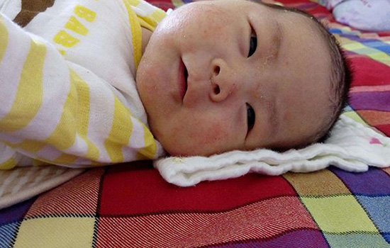 冬季宝宝皮肤究竟应该如何护理呢,冬天宝宝皮肤干用什么护肤品