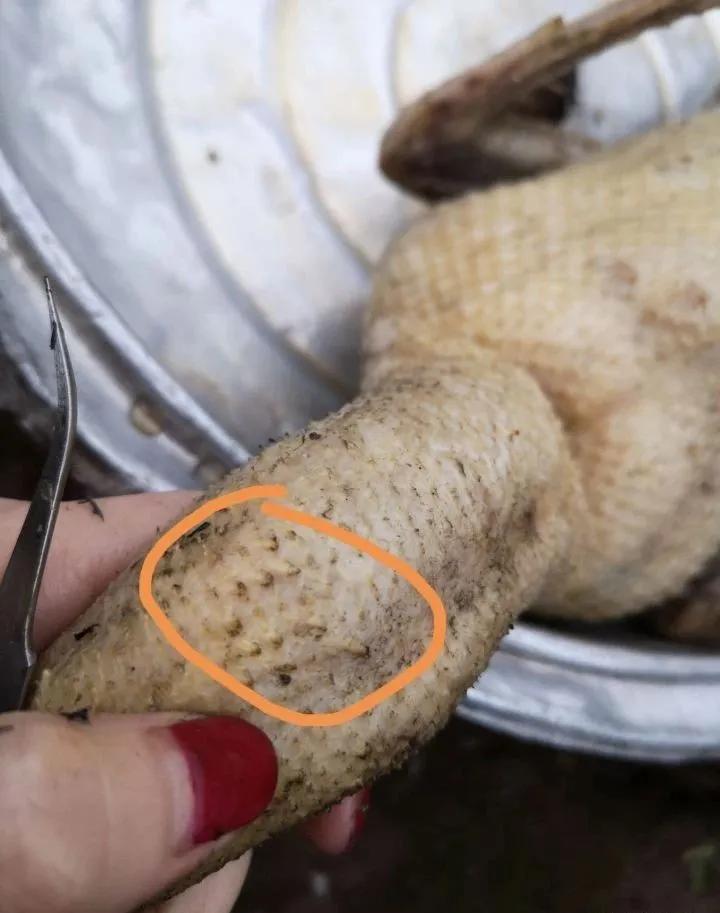 有必要把黑头故意挤出来吗,黑头真能挤出来那么多吗