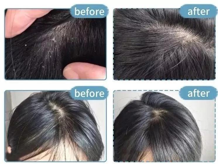 沙宣“退位让贤”，护发届翘楚“阿玛尼”上线，网友：良心洗发水