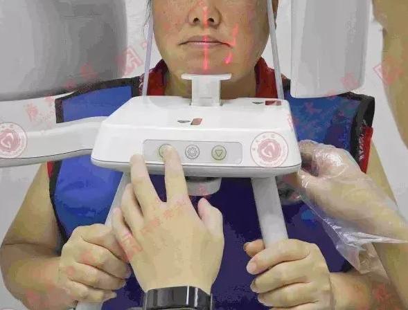 缺牙戴活动假牙40年有什么变化,上牙戴活动假牙的亲身经历