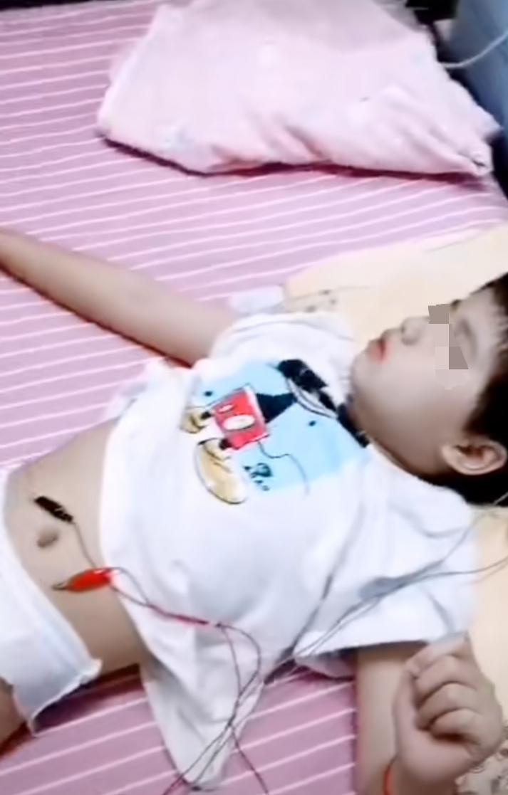 小孩学舞蹈瘫痪的案例,5岁女孩练舞蹈导致瘫痪