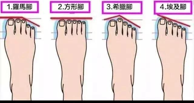 罗马脚不平衡问题,罗马脚希腊脚埃及脚各是什么特点