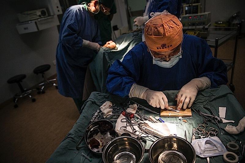 网红整容去世背后的医美生意：暴利、欺诈、占领县城