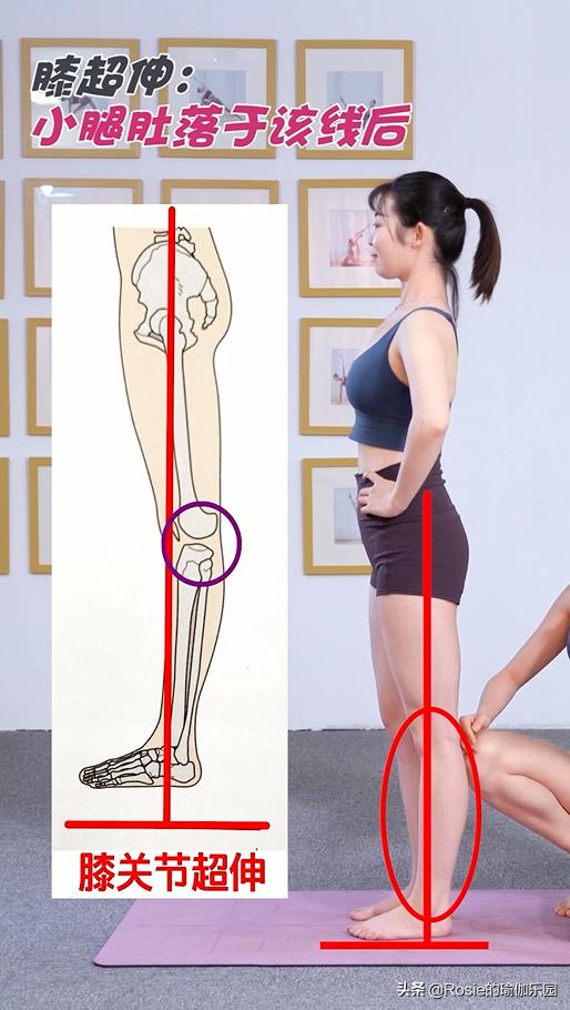 肌肉型小腿粗壮外翻如何变细腿,小腿粗壮如何变细腿健身动作