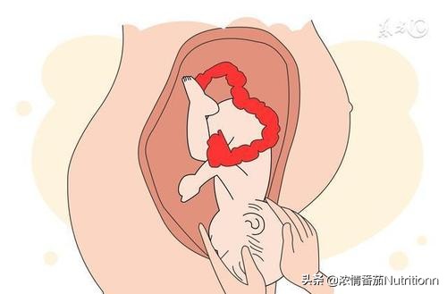 剖腹产和自然分娩的优点和缺点,剖腹产与自然生产有何区别