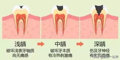 怎样预防龋齿拔牙,什么是蛀牙如何预防蛀牙