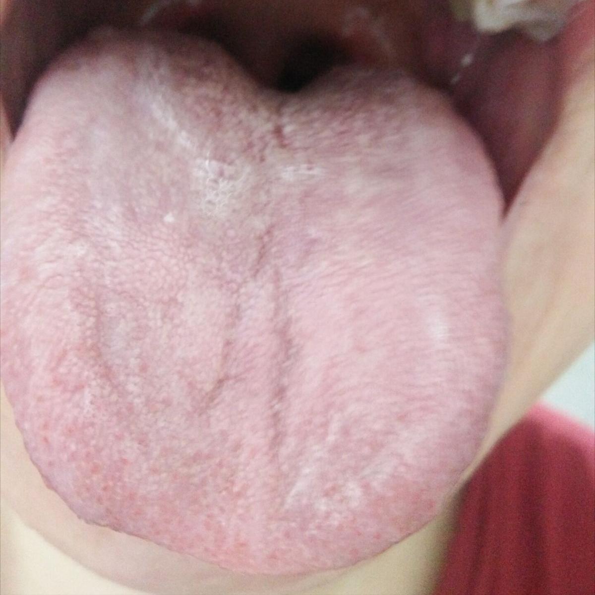 经期偏头痛发作停经,月经期间头晕有血块腰疼用什么药