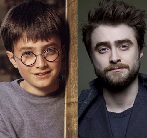 为什么英国人头越来越秃,英国谢顶