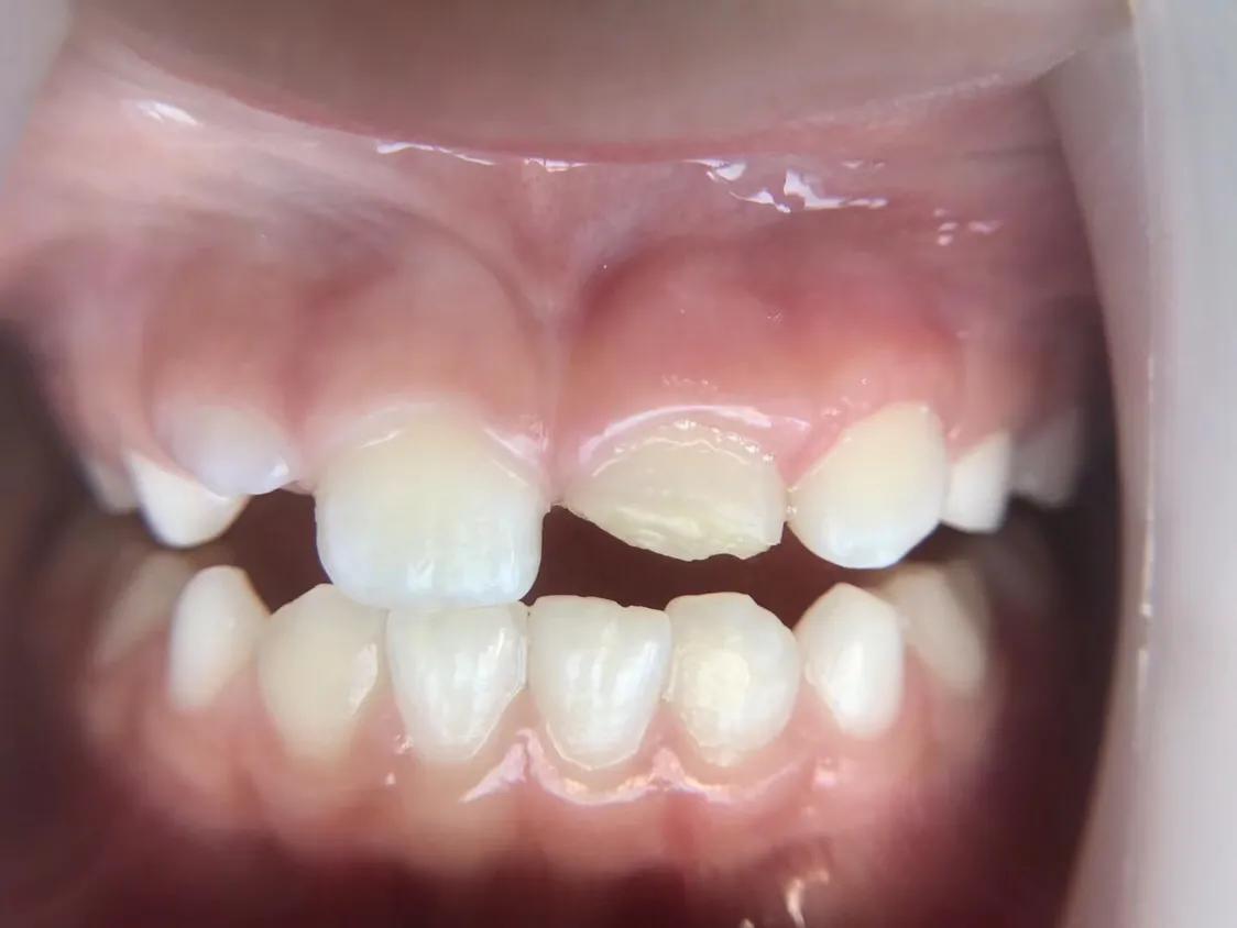 口腔垃圾怎么处理,口腔护理中的垃圾怎么分类处理